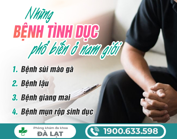 Hình ảnh minh họa